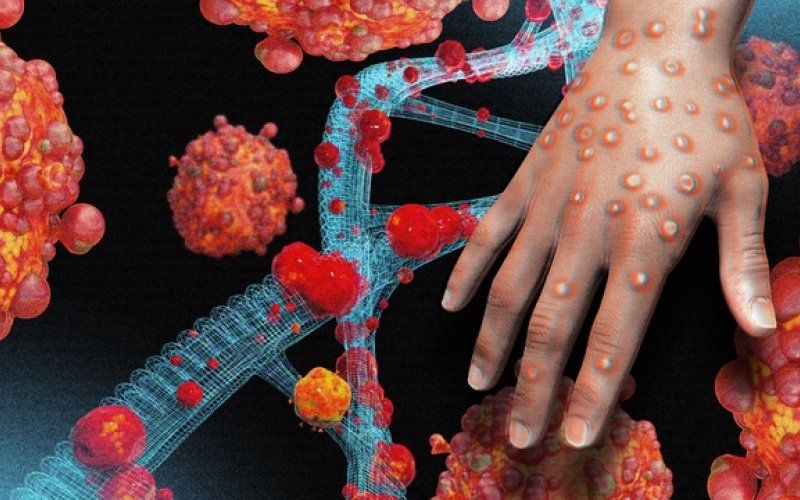 Thủ tướng yêu cầu sẵn sàng ứng phó dịch đậu mùa khỉ