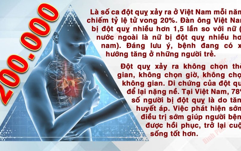 Mỗi năm Việt Nam có khoảng 200.000 ca đột quỵ