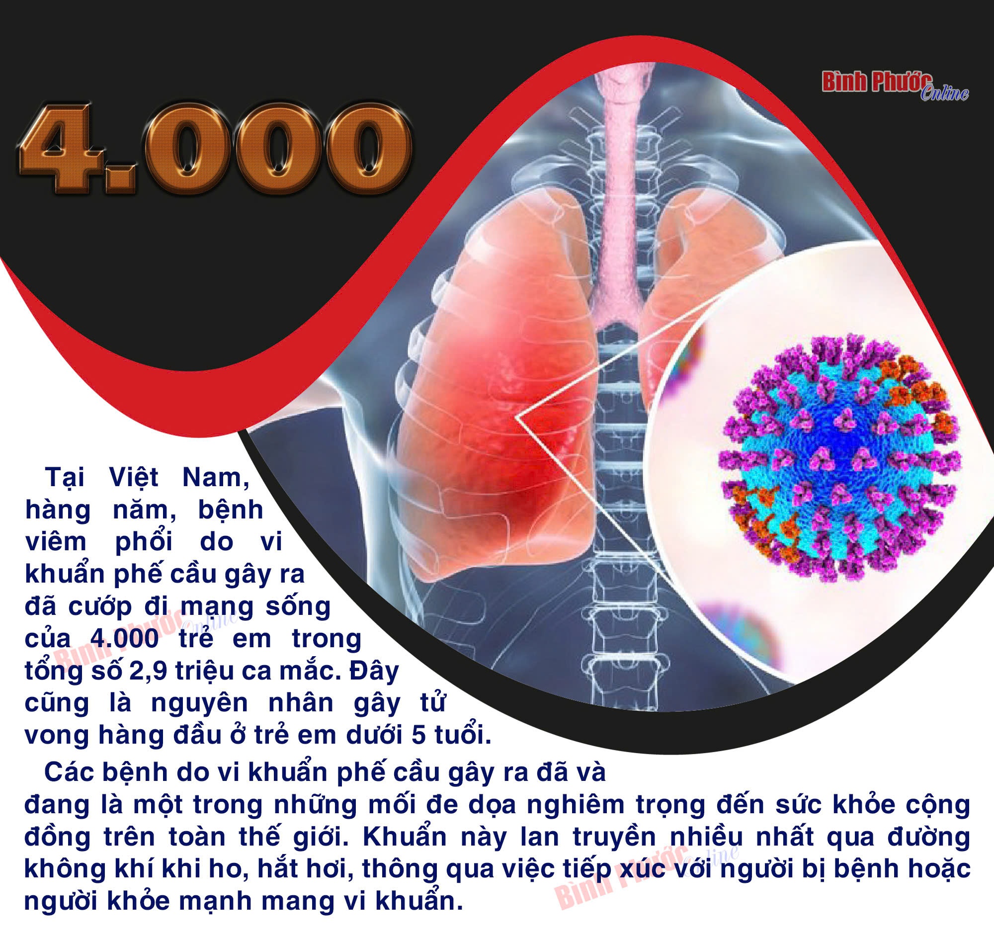 Việt Nam có 4.000 trẻ em tử vong do viêm phổi mỗi năm