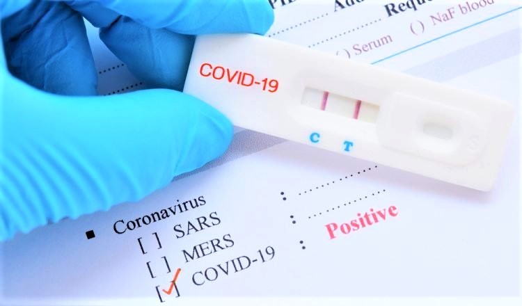 Dương tính giả là những bệnh nhân không bị nhiễm COVID-19 nhưng lại cho kết quả dương tính trong quá trình xét nghiệm. Hãy cùng tìm hiểu nguyên nhân và cách phòng tránh tình trạng này qua bức ảnh chứa đựng những thông tin hữu ích.