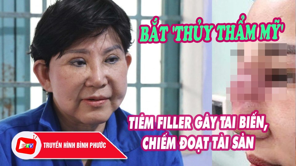 Bắt 'Thủy thẩm mỹ' tiêm filler gây tai biến và chiếm đoạt tài sản ở Tây Ninh |BPTV