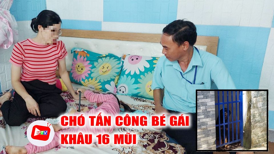 Bình Phước: Bé gái 3 tuổi bị chó hàng xóm cắn, phải khâu 16 mũi |BPTV