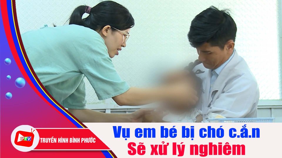 Bình Phước: Sẽ xử lý nghiêm vụ em bé bị chó c.ắ.n |BPTV