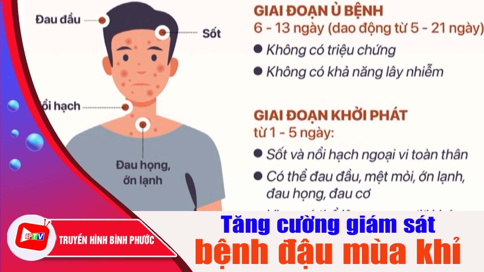Bộ Y tế yêu cầu tăng cường giám sát bệnh đậu mùa khỉ |BPTV