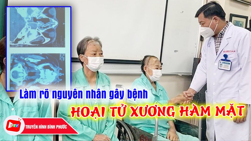 Bộ Y tế yêu cầu xác định nguyên nhân gây hoại tử xương hàm liên quan Covid-19 |BPTV
