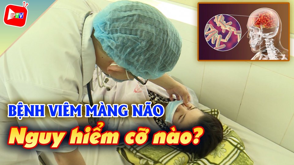 Cảnh báo bệnh viêm màng não virus có chiều hướng gia tăng