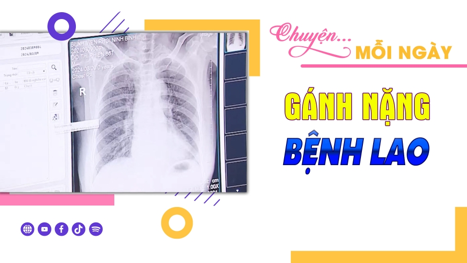 CHUYỆN MỖI NGÀY 26-10-2024 ||BPTV