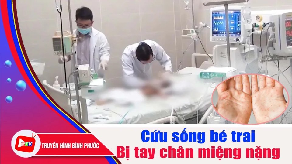 Cứu sống kịp thời bé trai 10 tháng tuổi ngưng tim vì tay chân miệng |BPTV