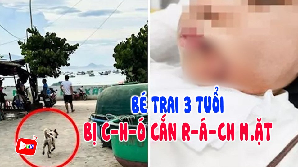 Đang đi du lịch cùng gia đình, bé trai 3 tuổi bị c-h-Ó cắn r-á-ch m.ặt |BPTV