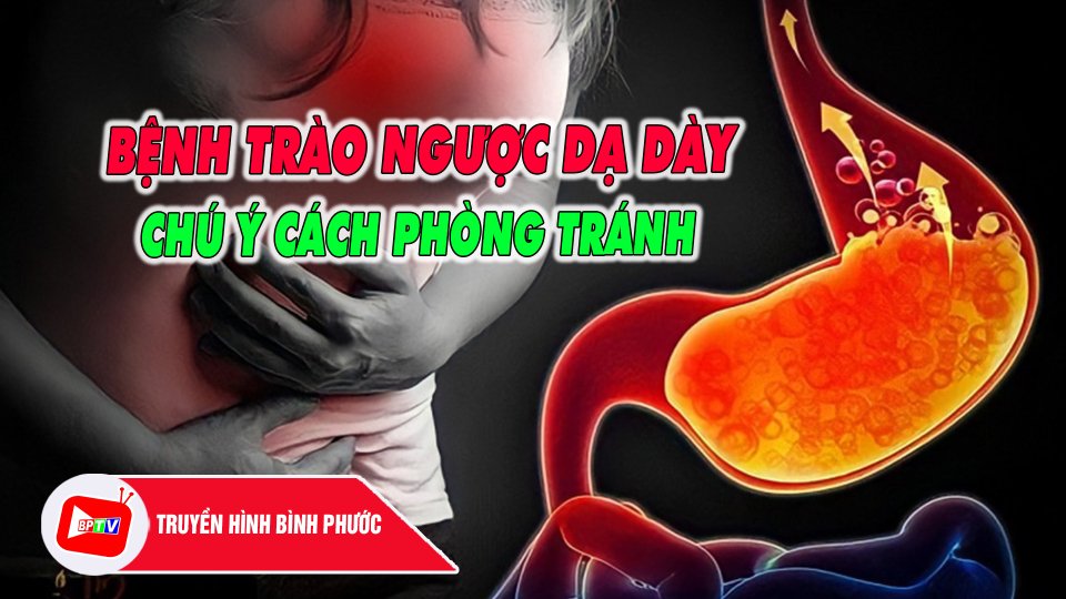 Gần 10% người dân Việt Nam mắc bệnh trào ngược dạ dày |BPTV
