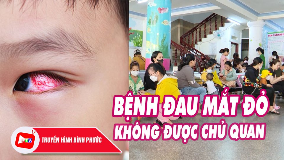 Gia tăng bệnh đau mắt đỏ mùa tựu trường: Bác sĩ khuyến cáo cách phòng tránh |BPTV
