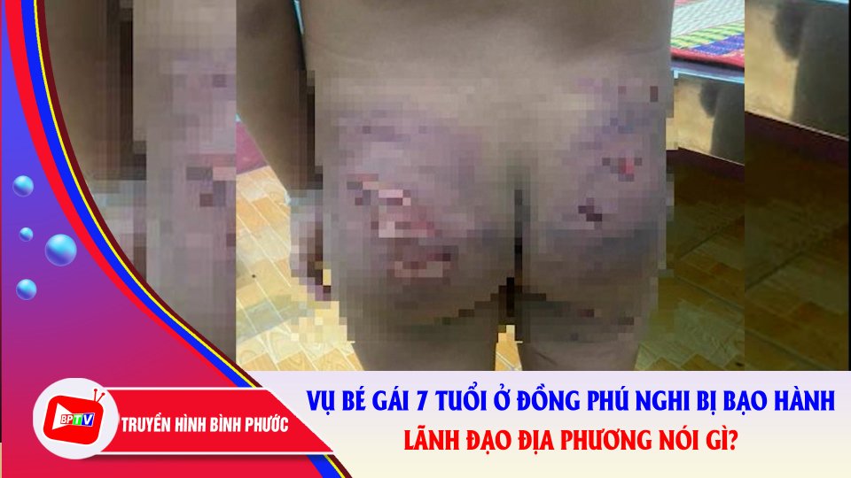 Lãnh đạo địa phương nói gì về bé gái 7 tuổi nghi bị người thân bạo hành? |BPTV