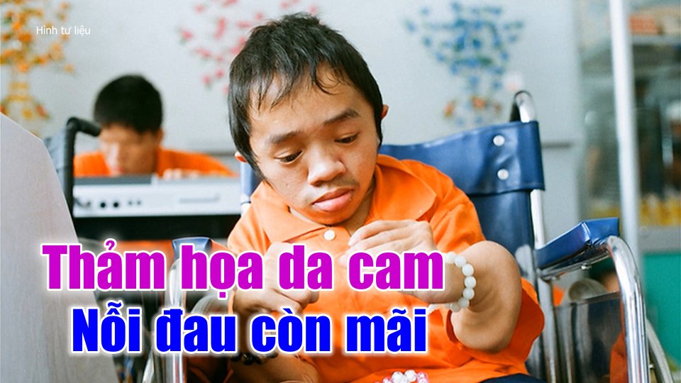 Những nỗi đau mang tên da cam |Truyền hình Bình Phước