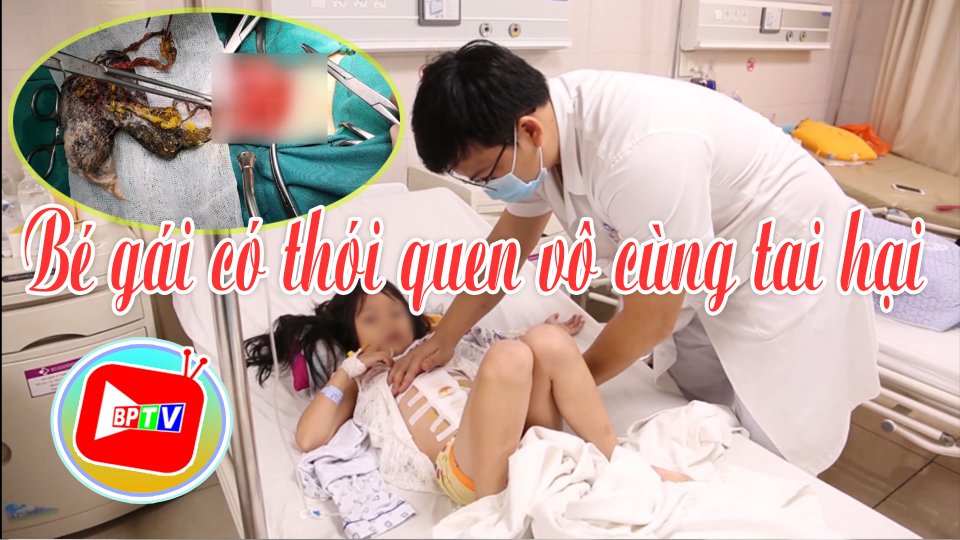 TIN TỨC 100 ĐỘ | 22-5-2021| Choáng với “dị vật” trong bụng bé gái 7 tuổi