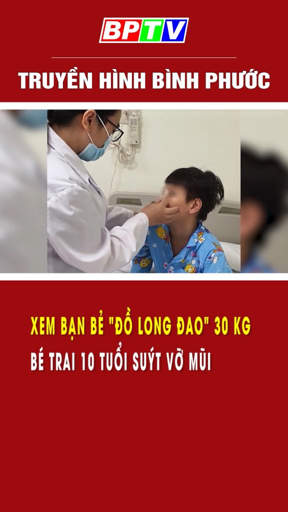 Xem bạn bẻ “Đồ long đao” 30 kg, bé trai 10 tuổi suýt vỡ mũi 