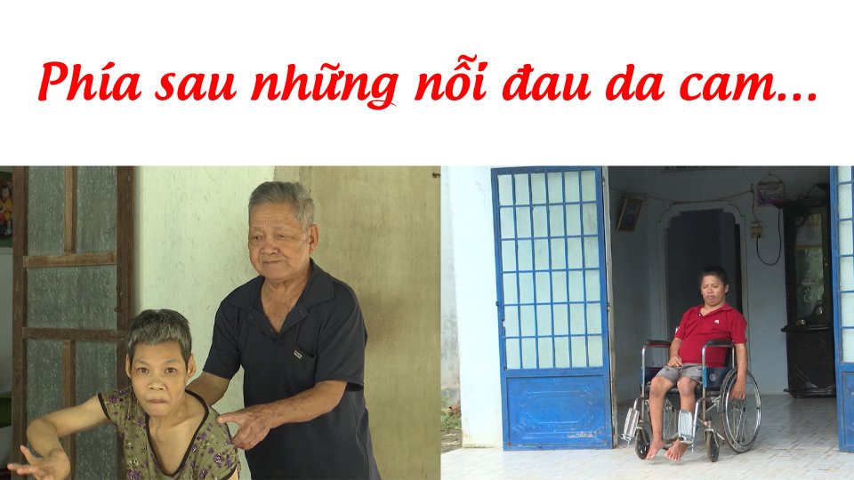 Xoa dịu nỗi đau da cam” | BPTV
