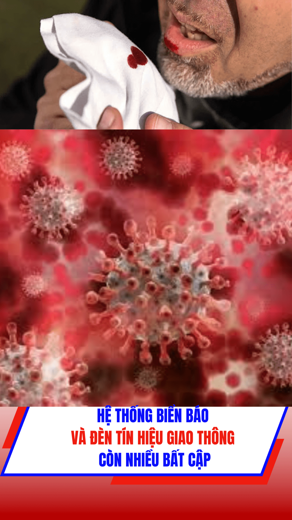 Xuất hiện virus lạ gây triệu chứng ho ra máu ở Nga #shorts